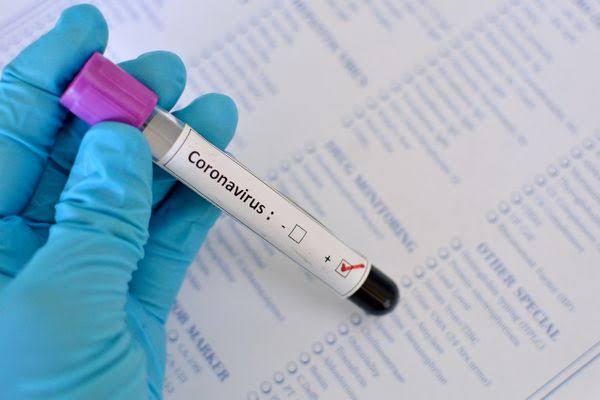 Covid-19. Brusque registra primeiro óbito associado ao coronavírus